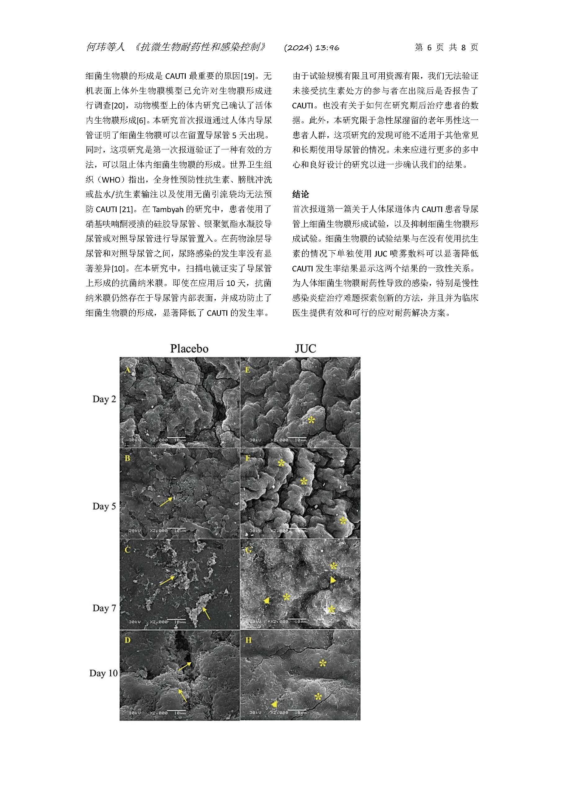 全球首次报道人体内抗细菌生物膜耐药研究成果